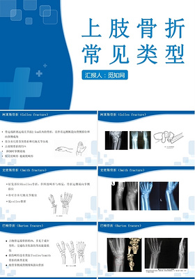 蓝色上肢骨折常见类型上肢骨折护理查房